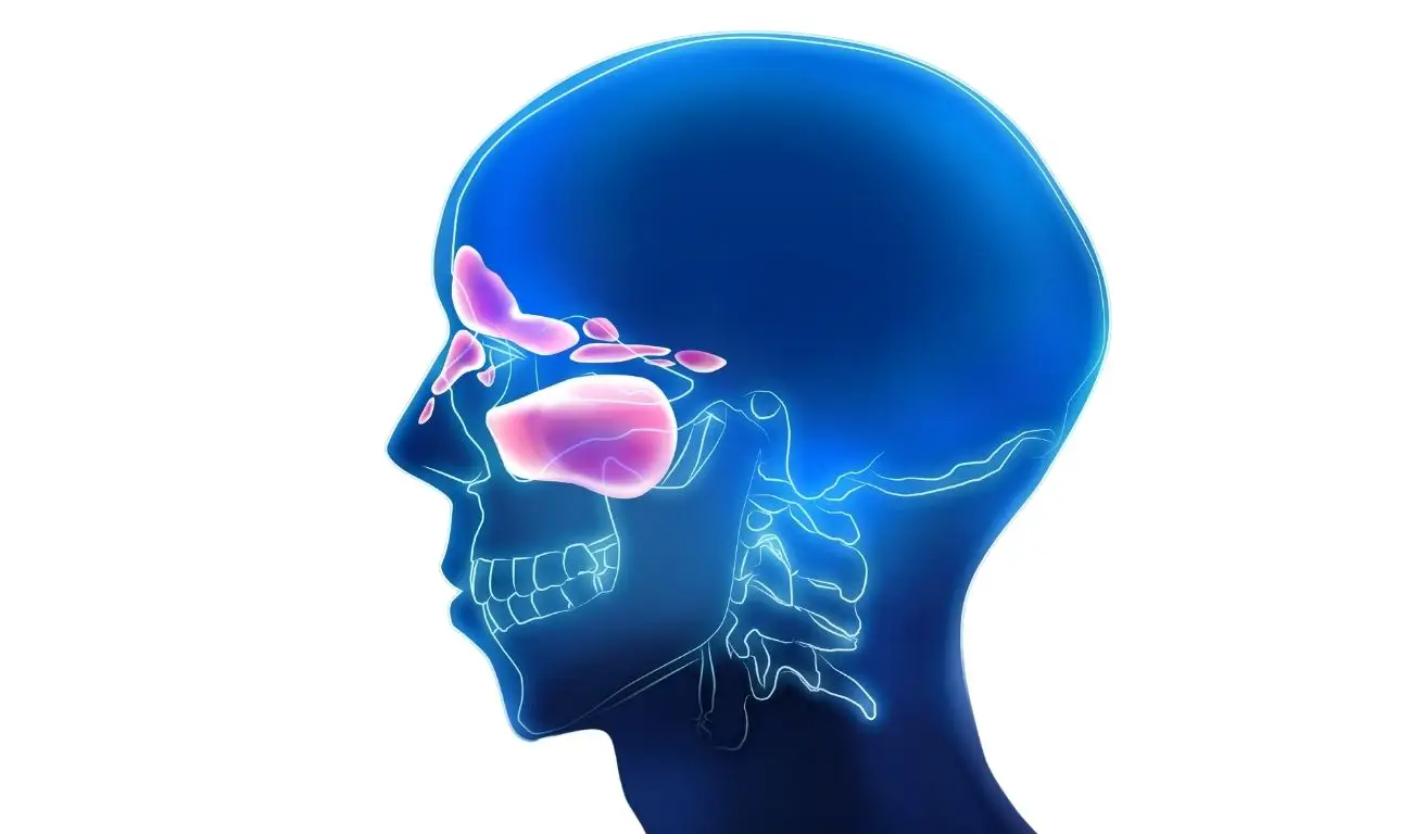 OPT_Sinusitis